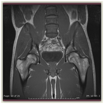 MRI
