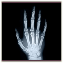 X-Ray X-Ray